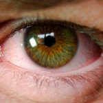 Mutirões de saúde ocular vão atender pessoas em situação de rua