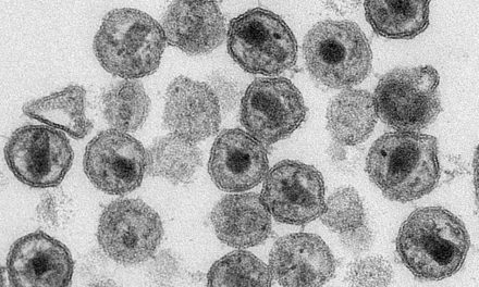 Cientistas identificam novo subtipo do vírus HIV
