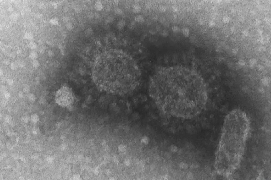 Ebola, Sars: mortes por 5 vírus vão aumentar em 12 vezes até 2050 por causa das mudanças climáticas