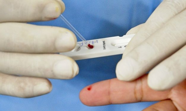 Conselho alerta para risco de apagão de testes de covid-19 em Minas Gerais
