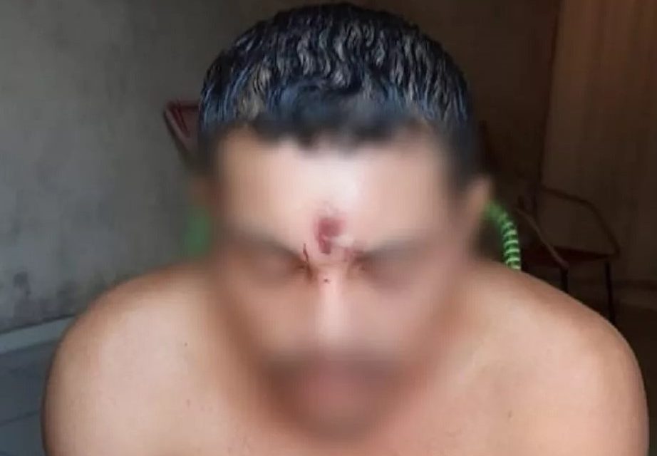 Jovem leva tiro na testa, cai de moto e vai para casa dormir