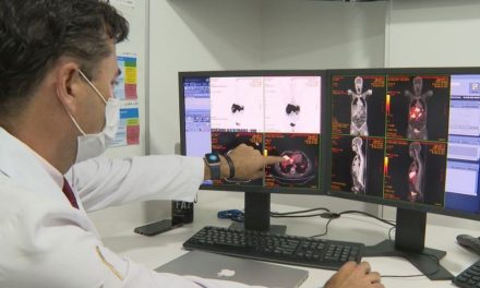 Câncer de próstata tem novo tratamento com radioterapia reduzida