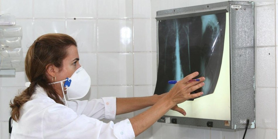 Brasil registra aumento de quase 5% nos casos de tuberculose