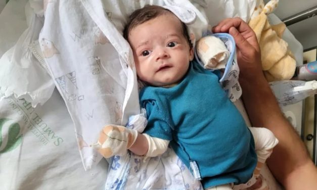 Bebê é diagnosticado com doença rara que faz pele ser tão frágil quanto asas de borboleta em MG