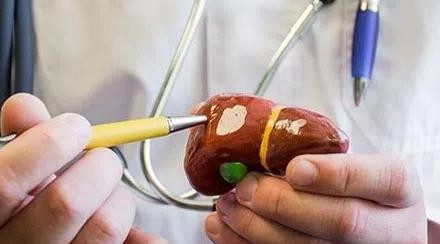 Saiba mais sobre o tratamento e a prevenção da hepatite A