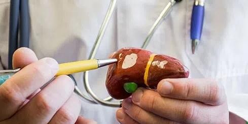 Saiba mais sobre o tratamento e a prevenção da hepatite A