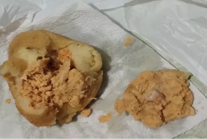 Mulher morde coxinha e encontra dente humano