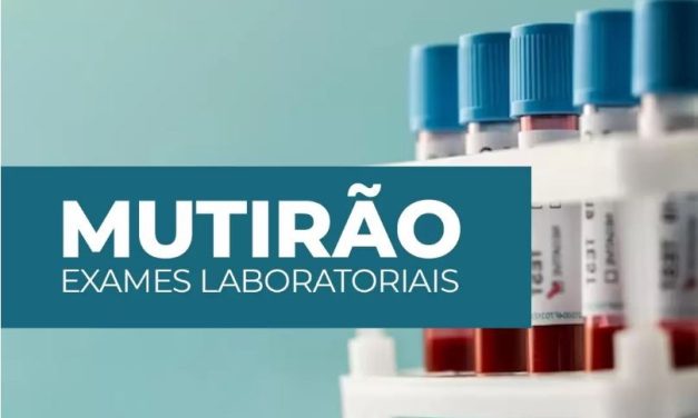 Secretaria de Saúde de Formiga inicia mutirão de exames laboratoriais