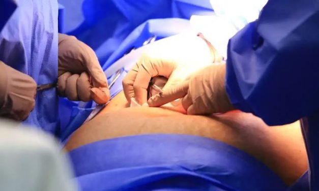 Cinco estados podem zerar fila de cirurgias no SUS