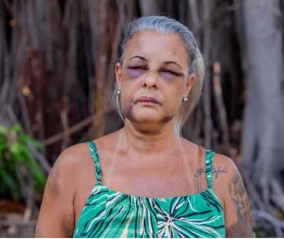 Professor de jiu-jítsu é preso após agredir ex-mulher por seis horas