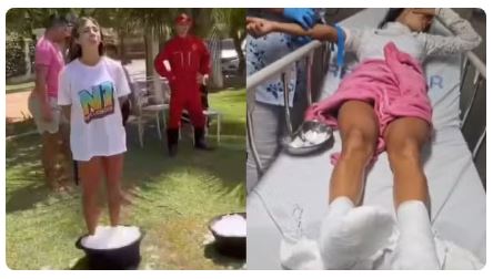Influenciadores têm queimaduras e são socorridos após ficarem com pés imersos em gelo com sal para reality