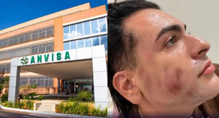 Após morte de empresário, Anvisa proíbe venda e uso de produtos à base de fenol