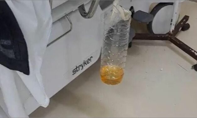 Sem materiais básicos, Hospital João XXIII usa garrafa PET para recolher urina de pacientes