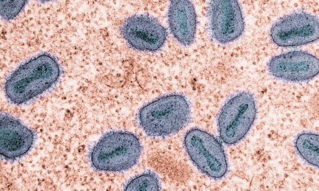 Região Norte do Brasil registra casos de mpox
