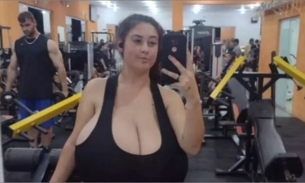 Jovem com doença rara remove 10kg de seios em cirurgia; veja antes e depois