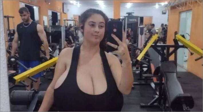 Jovem com doença rara remove 10kg de seios em cirurgia; veja antes e depois