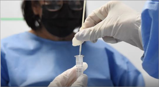 Quase 19% das pessoas que tiveram covid-19 têm sintomas persistentes