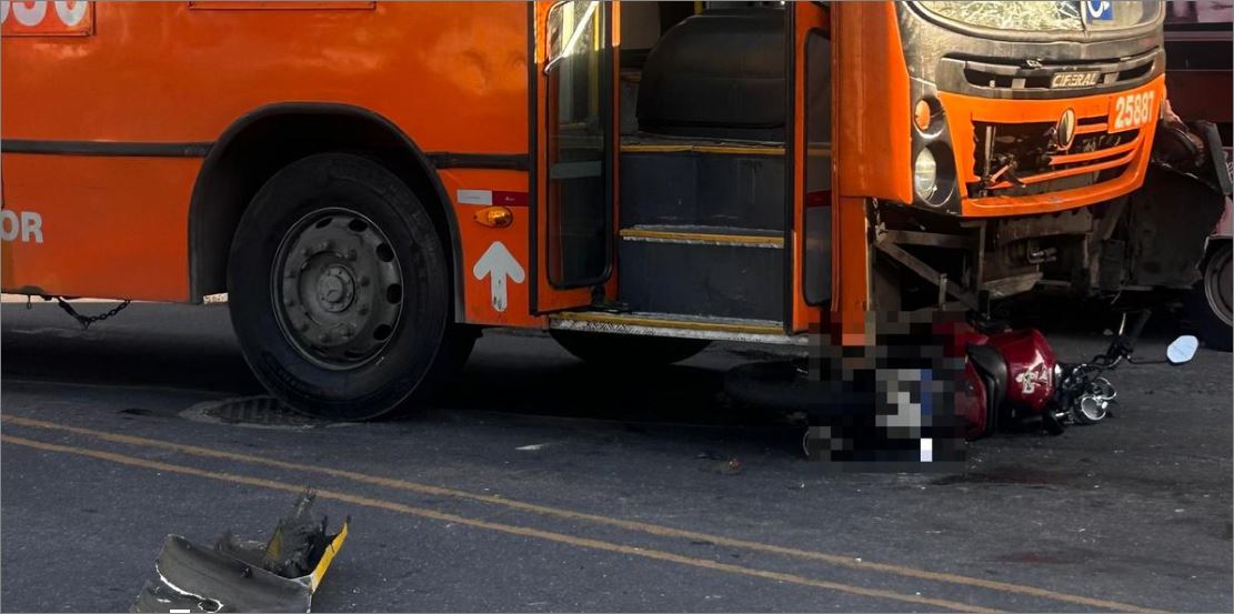 Moto invade contramão, bate de frente em ônibus e casal sofre fraturas nas pernas, em Venda Nova