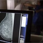 Câncer de mama: uma em cada três pacientes tem menos de 50 anos