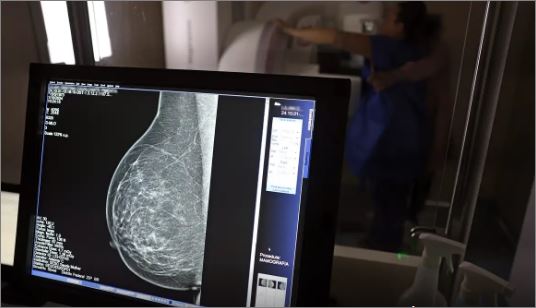 Câncer de mama: uma em cada três pacientes tem menos de 50 anos