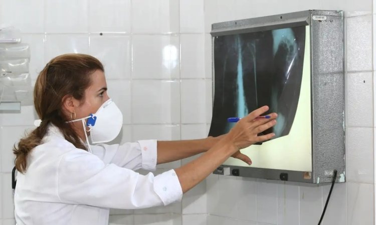 Uberlândia tem 49 casos de tuberculose  