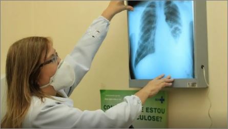 Baixo financiamento mundial ameaça combate à tuberculose