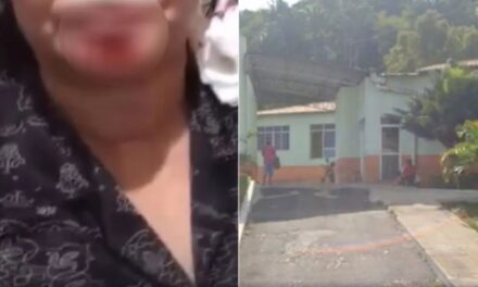 Homem é preso após dar mata-leão e arrancar pedaço do queixo da companheira com mordida