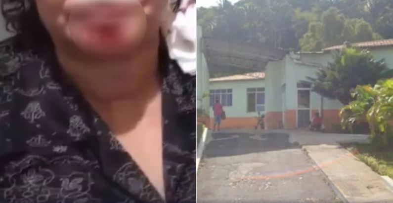 Homem é preso após dar mata-leão e arrancar pedaço do queixo da companheira com mordida