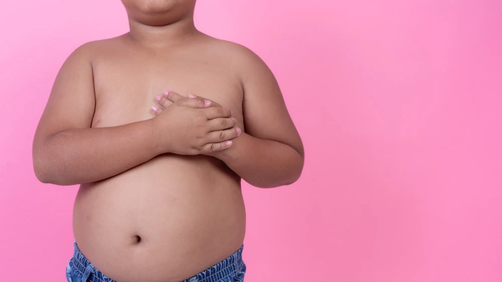 Obesidade pode interferir negativamente no tratamento contra câncer infantil