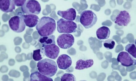 Novo estudo descobre como proteína afeta crescimento de células de câncer
