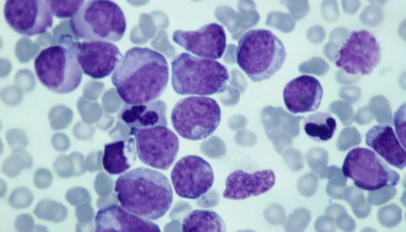 Novo estudo descobre como proteína afeta crescimento de células de câncer