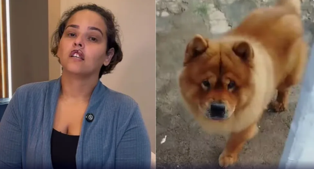 Mulher tem lábio arrancado por cachorro e passa por cirurgia de reconstrução