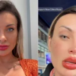 Andressa Urach pede orações após cirurgia para mudar cor dos olhos: ‘urgente’