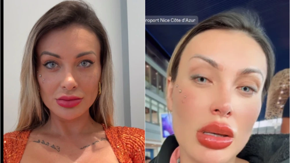 Andressa Urach pede orações após cirurgia para mudar cor dos olhos: ‘urgente’