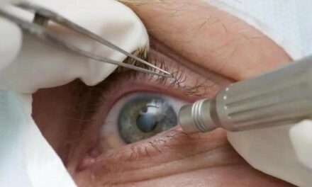 Cirurgia que altera cor do olho tem uso restrito para pessoas cegas