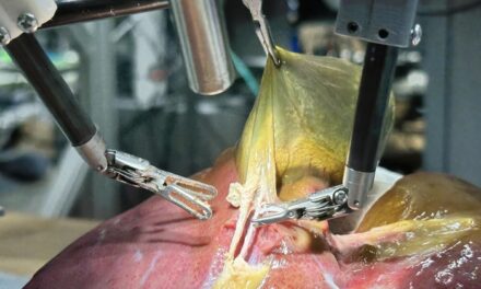 Robô faz cirurgia orientado por IA e sem nenhuma assistência humana