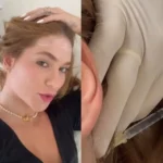 Virginia Fonseca revela ‘cura’ de doença após tratamento especializado: ‘Passei por muita coisa’