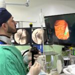 Santa Casa realiza procedimento inovador de endoscopia