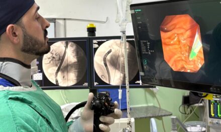Santa Casa realiza procedimento inovador de endoscopia