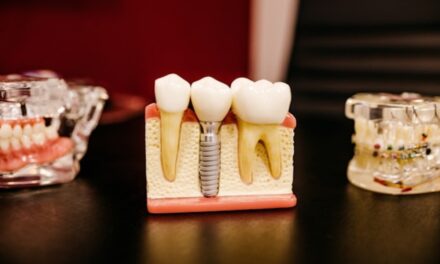 Diabéticos podem realizar implantes dentários? Descubra os exames e cuidados essenciais