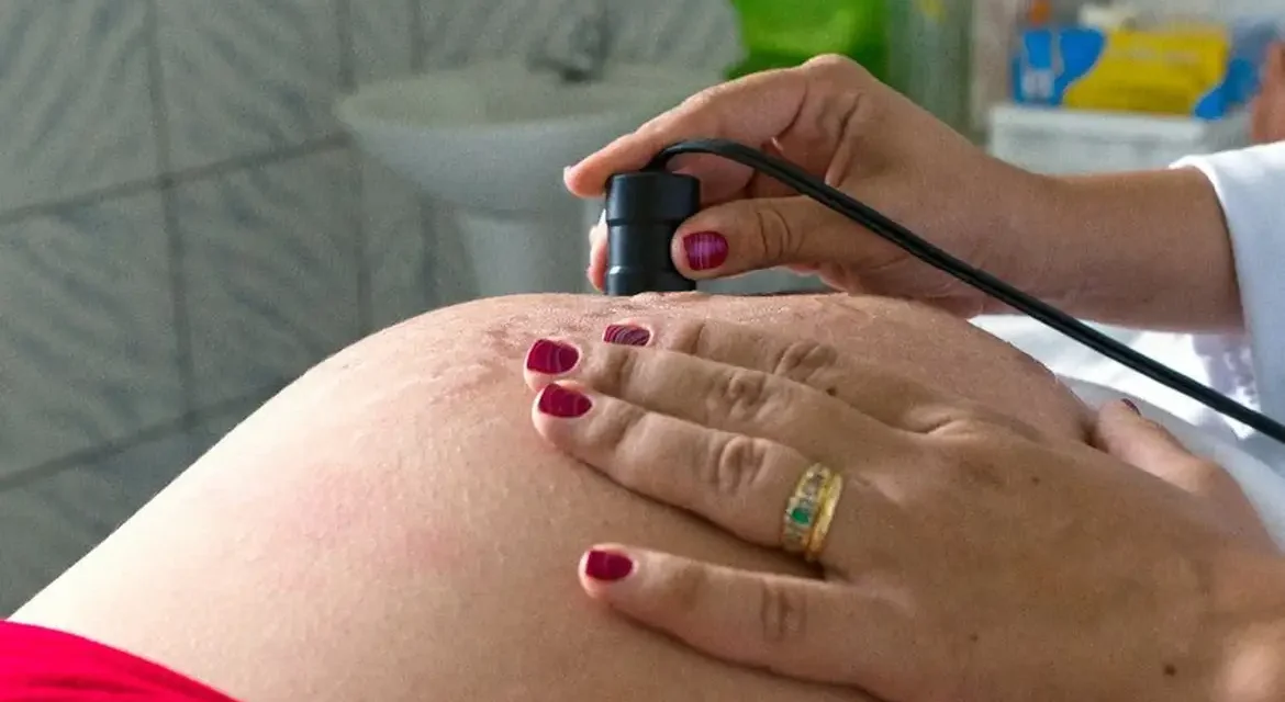 Parto humanizado avança no Brasil, mas pré-natal ainda enfrenta falhas graves