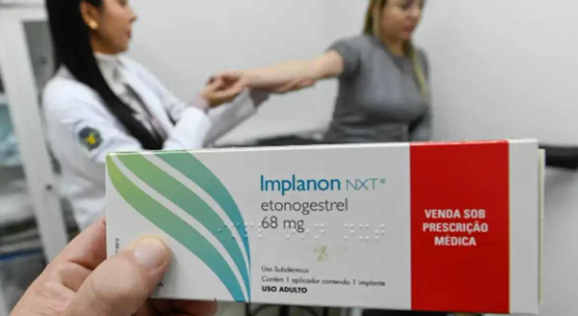 Implante contraceptivo passa a ser ofertado por planos de saúde