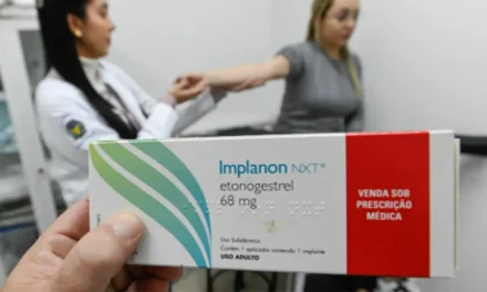 Implante contraceptivo passa a ser ofertado por planos de saúde