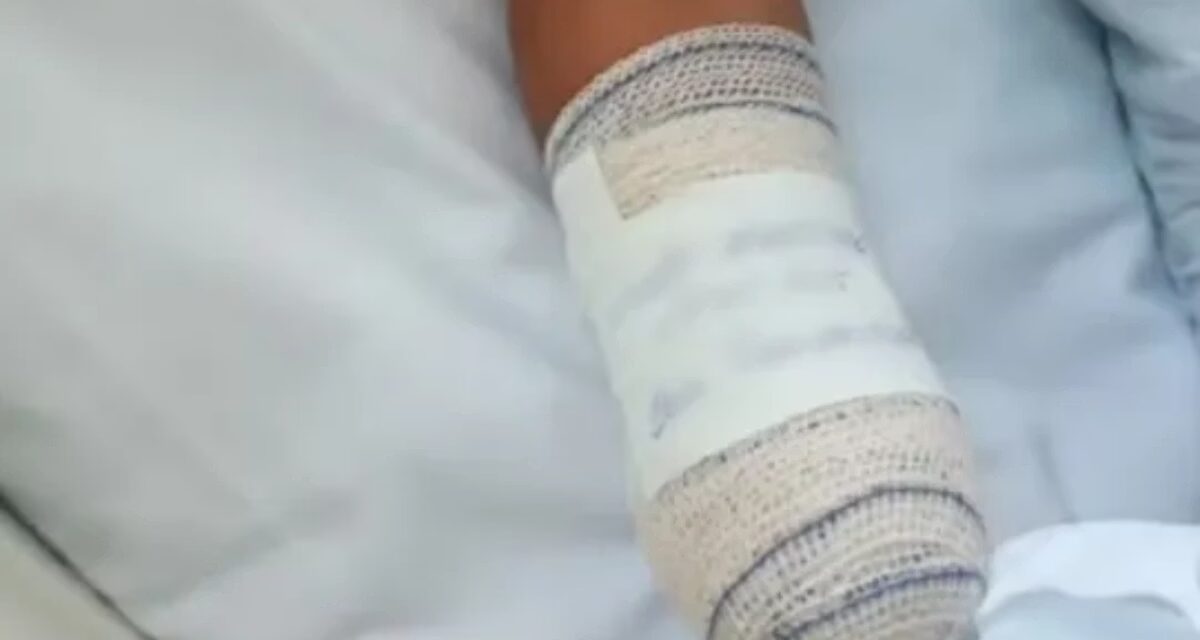 Criança perde a mão após confundir bomba com peça de bicicleta no Rio