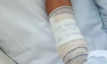 Criança perde a mão após confundir bomba com peça de bicicleta no Rio