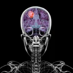 Estudo revela que glioblastoma afeta o corpo além do cérebro e compromete sistema imunológico