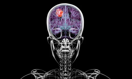 Estudo revela que glioblastoma afeta o corpo além do cérebro e compromete sistema imunológico