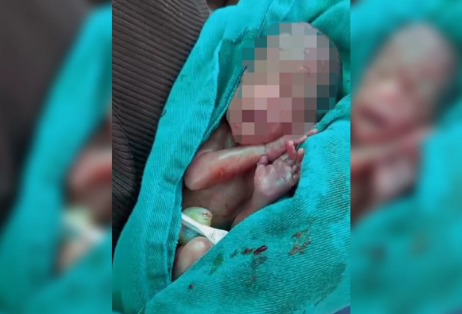 Bebê declarado morto e encontrado vivo no velório não resiste a complicações em Rio Branco