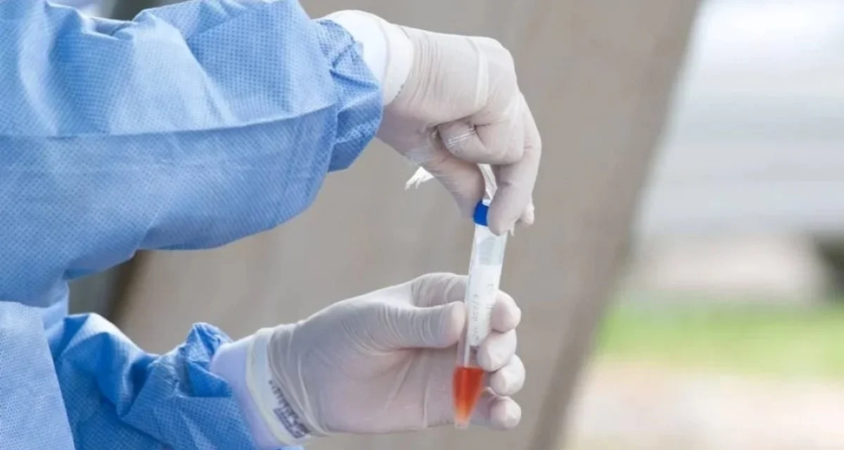 Saúde põe em sigilo valor da compra de 73 milhões de testes de Covid