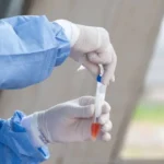 Saúde põe em sigilo valor da compra de 73 milhões de testes de Covid